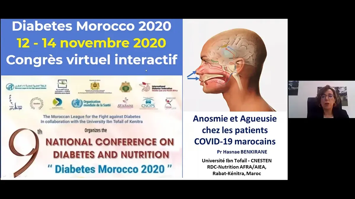 Anosmie et agueusie chez les patients COVID-19.