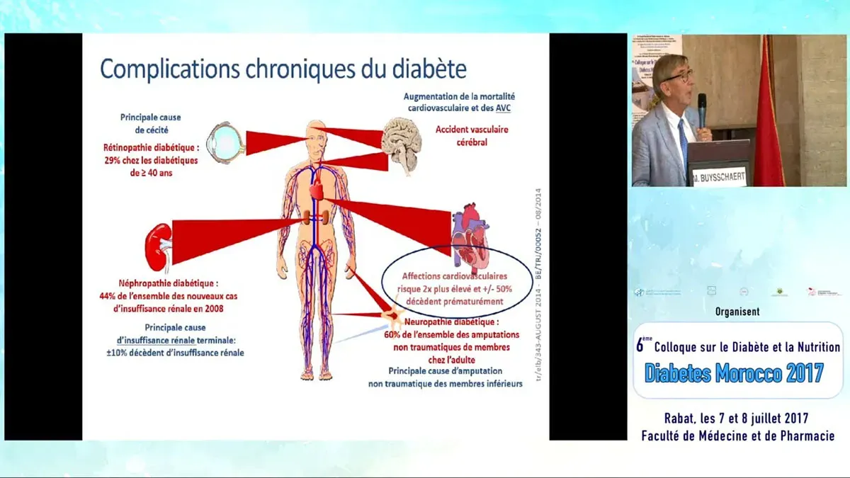 Diabète et complications buccodentaires