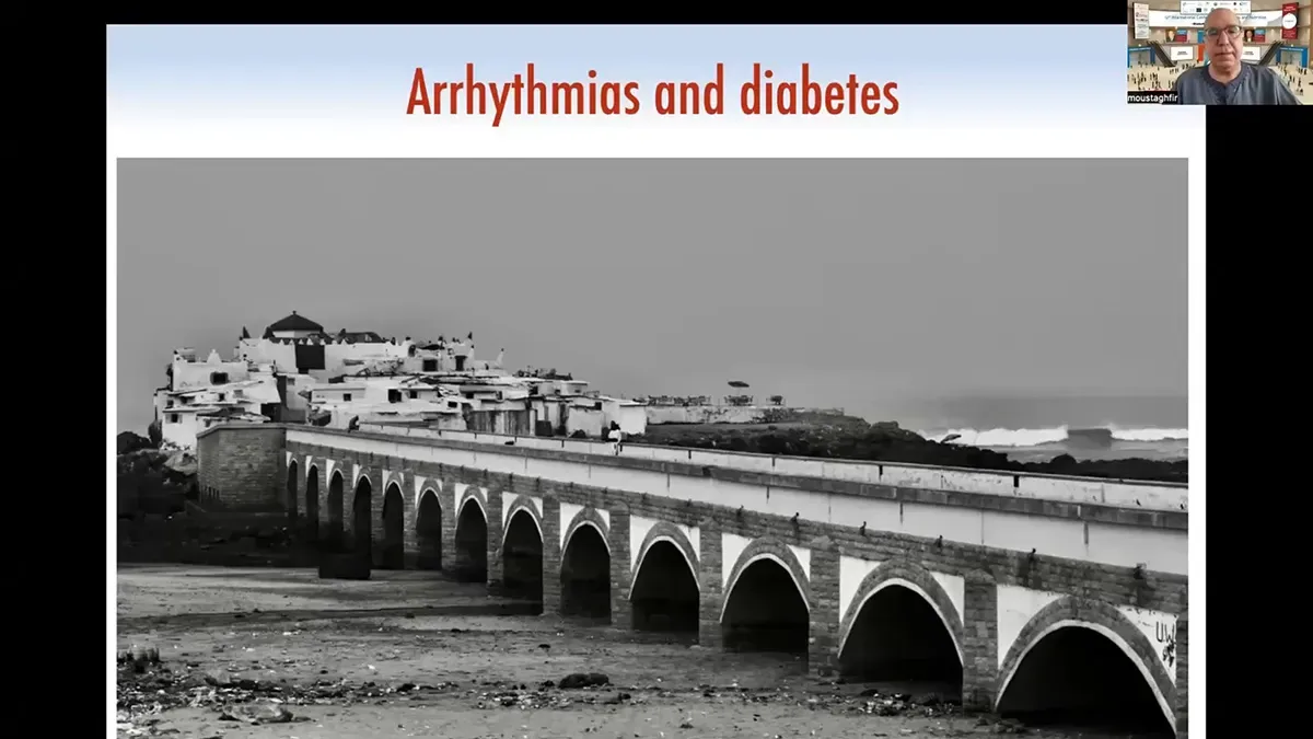 Diabète et troubles du rythme.