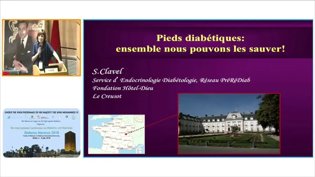 Le pied   diabétique : Un grave problème médical et un drame social