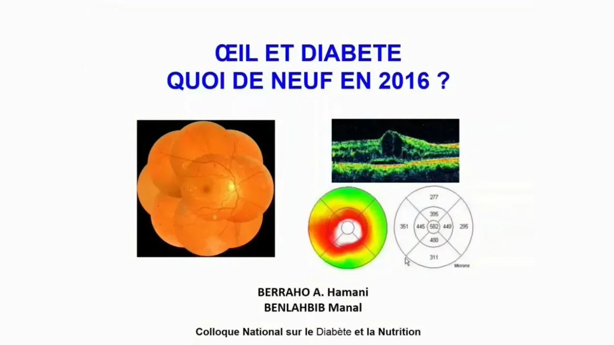 Œil et diabète.