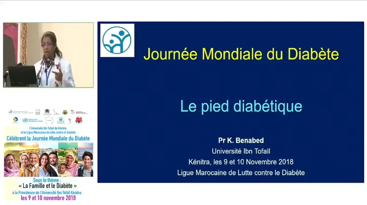Pied diabétique : Comment éviter les risques ?