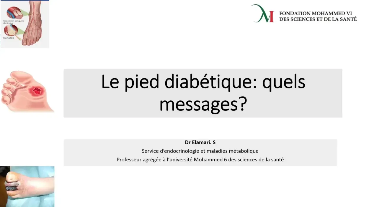 Pied diabétique : Quels messages ?