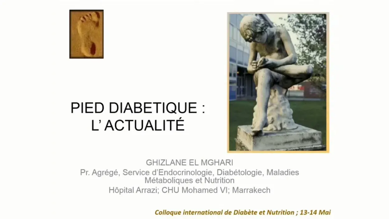 Pied et diabète.