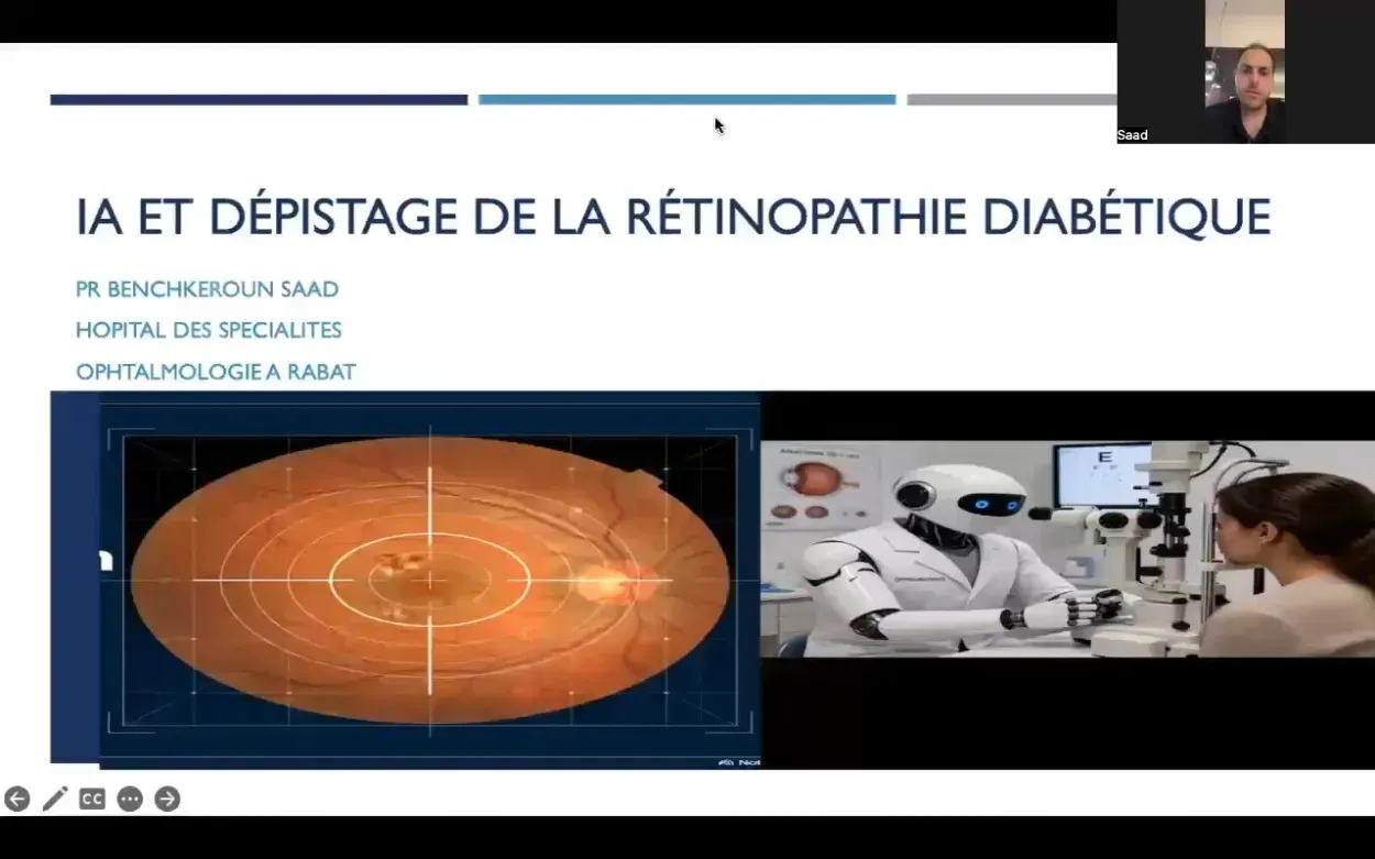 Rétinopathie diabétique et apport de l’intelligence artificielle